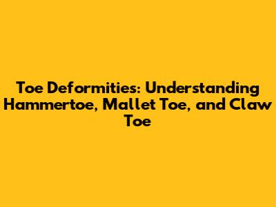 Toe Deformities: Understanding Hammertoe, Mallet Toe, and Claw Toe